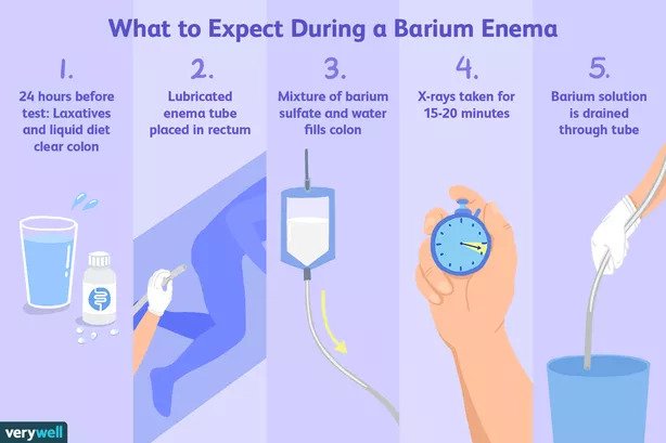 Your Healthcare Provider has Ordered a Barium Study