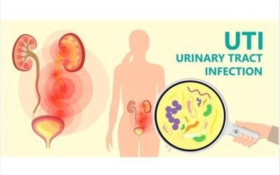 Urinary Infection Prevention, Neurogenic Bowel & SCI